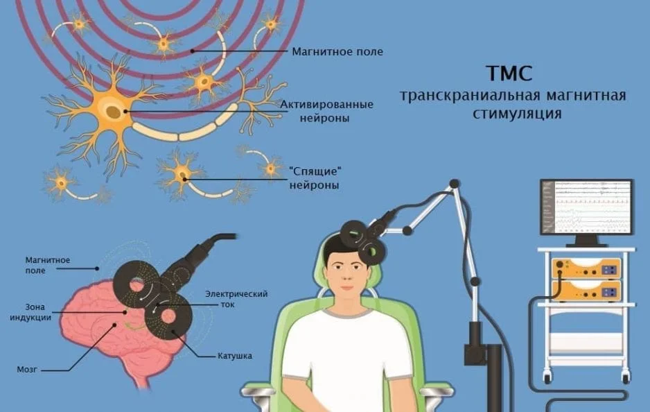 транскраниальды магниттік ынталандыру Астанадағы 